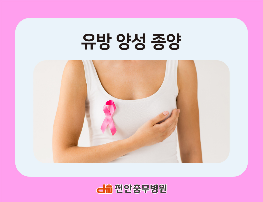 [전문의 칼럼] 유방 양성 종양